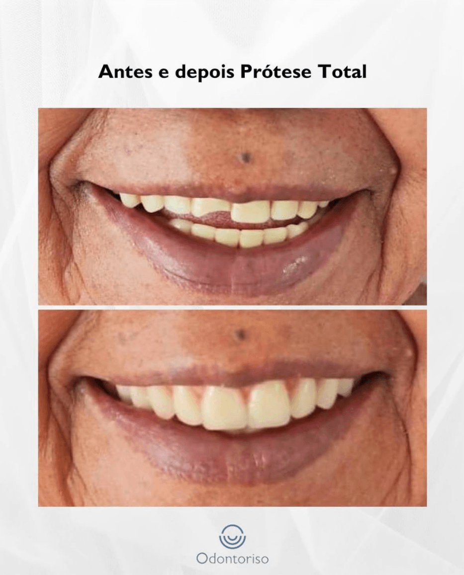 Resultado 1