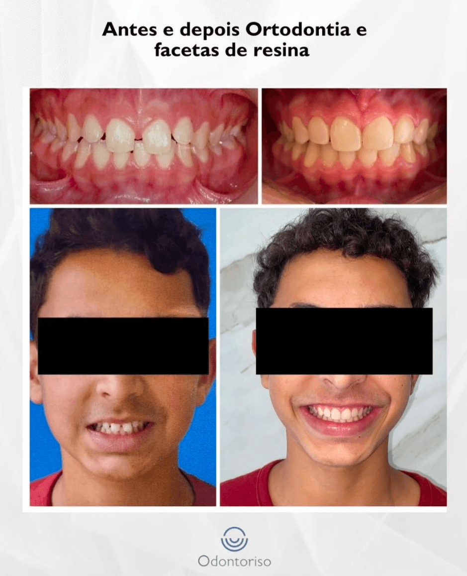 Resultado 11