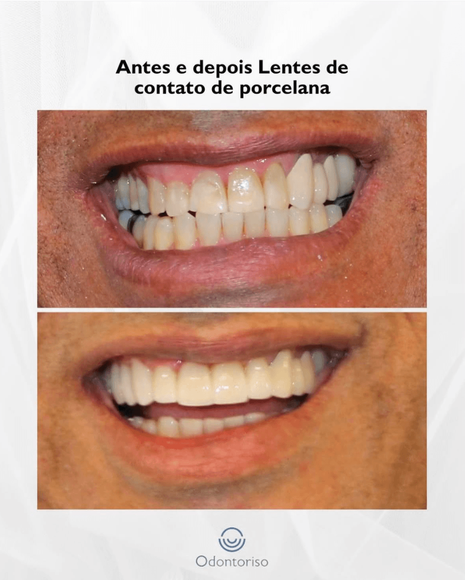 Resultado 3