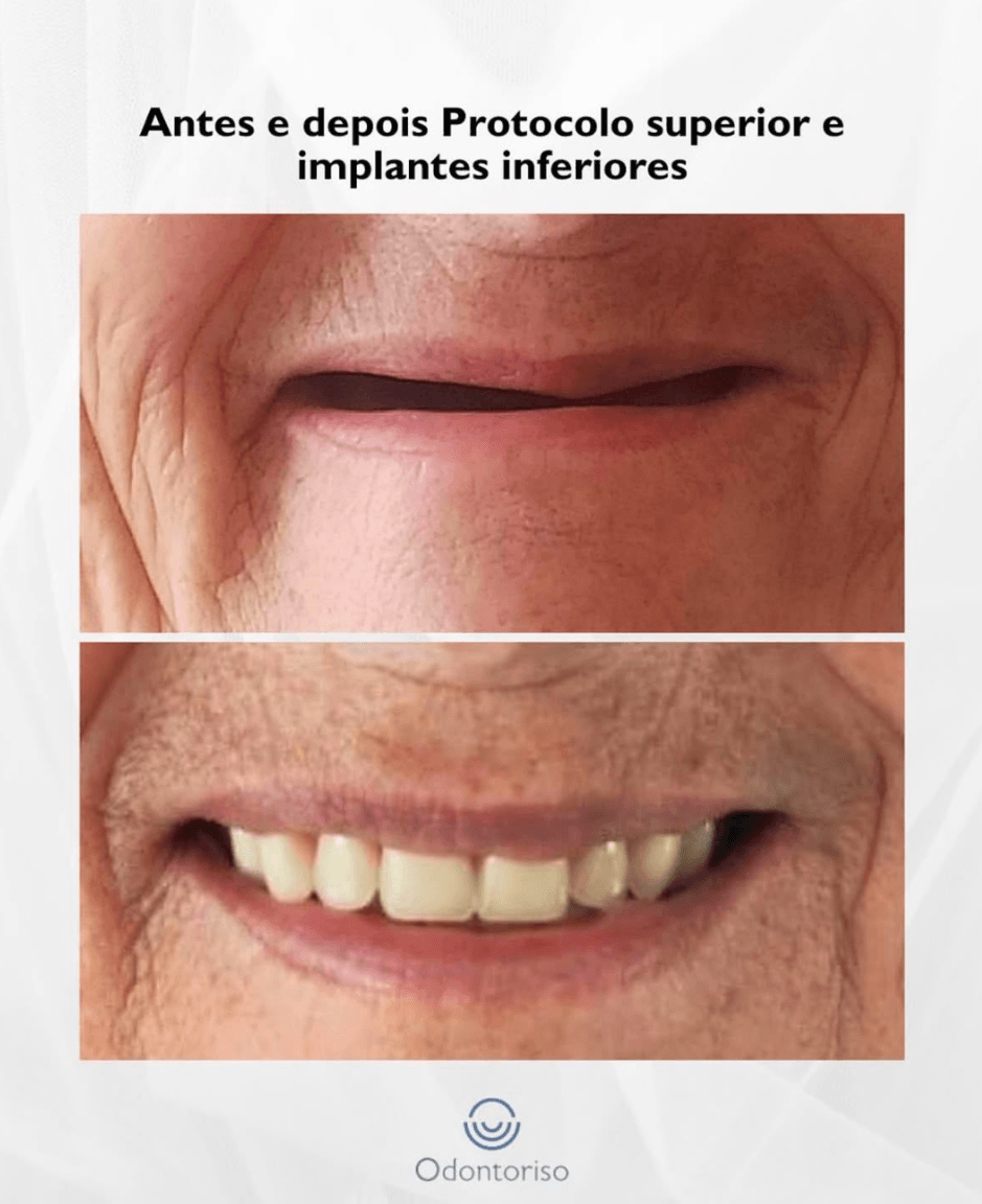 Resultado 5