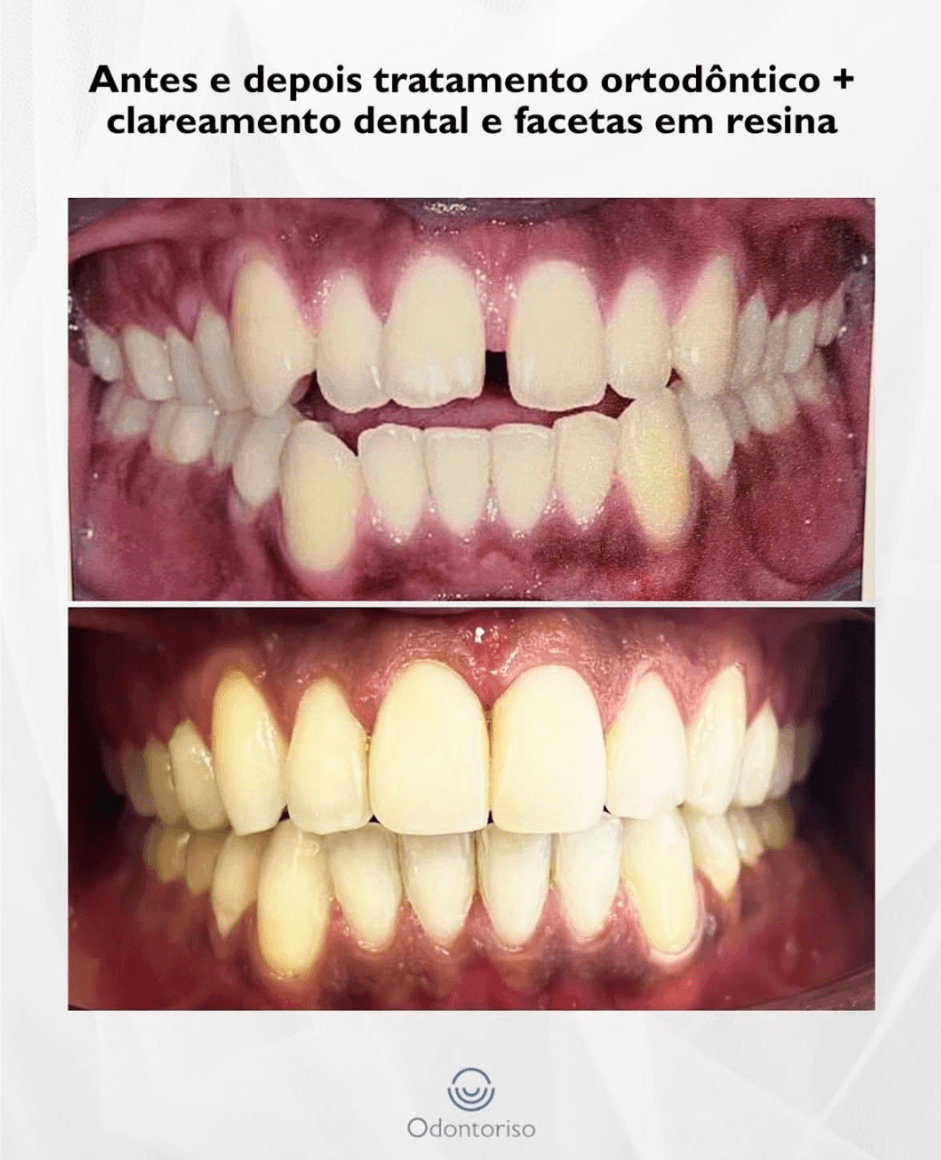 Resultado 6